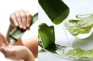 Aloe Vera a home remedy for ingrown hairs