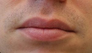 Best Lip Exfoliator – Natural, Drugstore & for Men Reviews man2