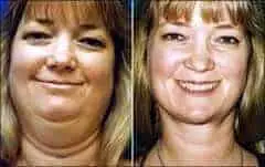 Facial toning exercises before and after