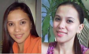 Before and after use of skin whitening pills