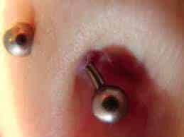 Rejecting Navel Piercing signs
