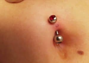 Navel Piercing Infection signs