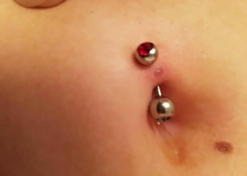 Navel Piercing Infection signs