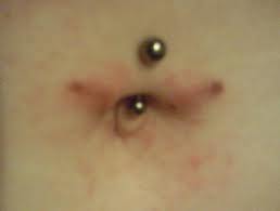 rejected belly button piercing symptoms