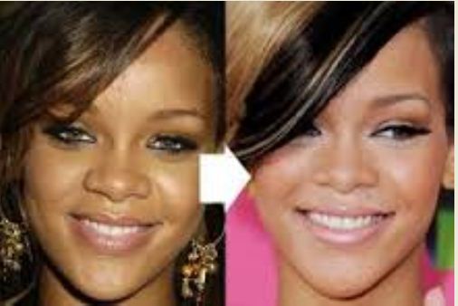 rihanna skin lightened