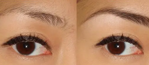 Before and after use of castor oil for eyebrow growth