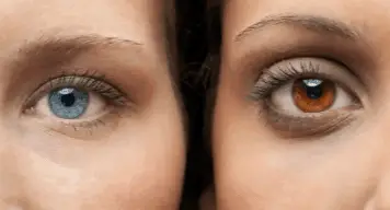 How much does permanent eye color change cost