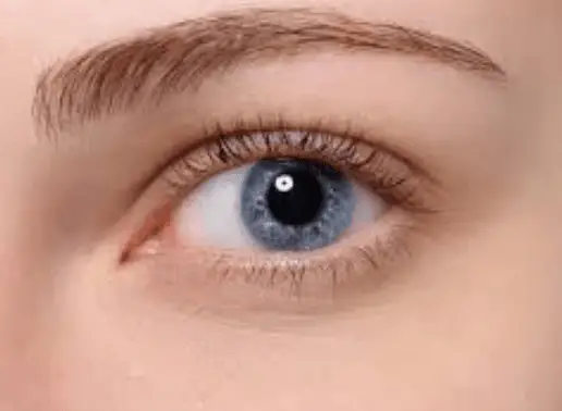 Eyelash mites treatment