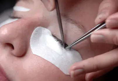 How to get rid of ingrown eyelash hair