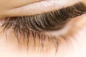Eyelash Mites