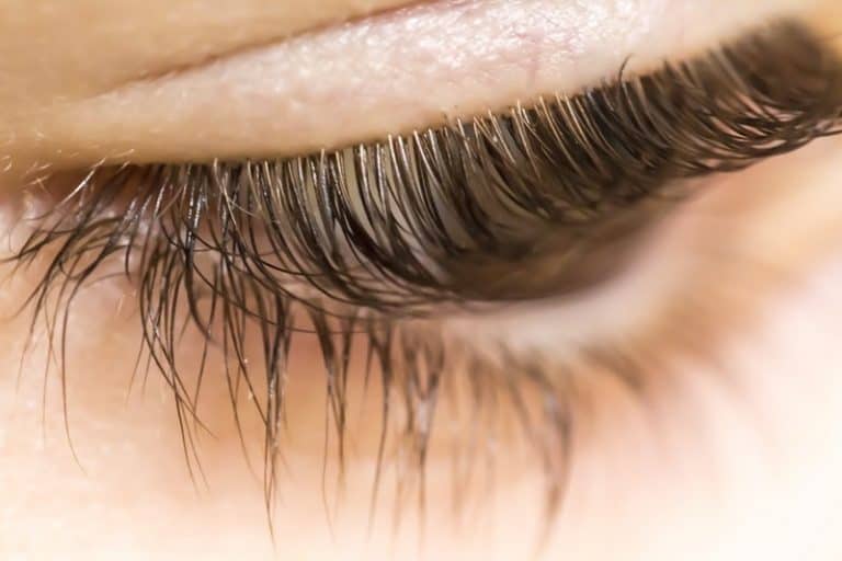 Eyelash Mites Causes And Prevention 